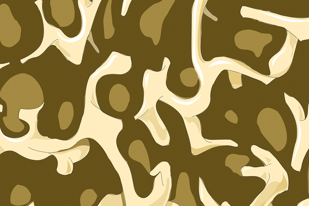 En illustration av osteoporos